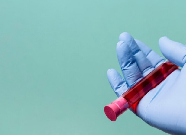 Какие могут быть последствия после мононуклеоза? Какие могут быть последствия после мононуклеоза?