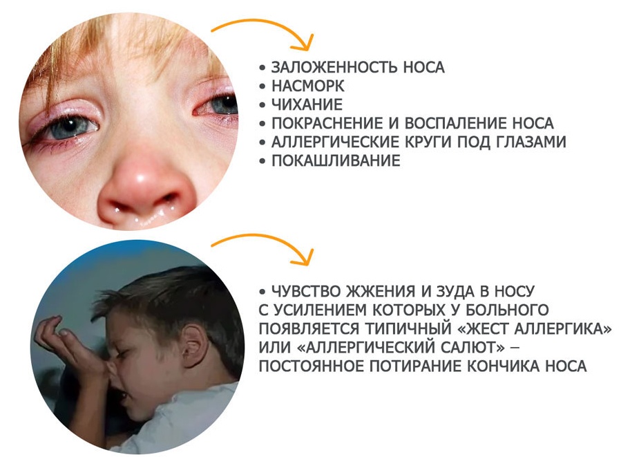 Чем может быть вызвано постоянное чихание? Чем может быть вызвано постоянное чихание?